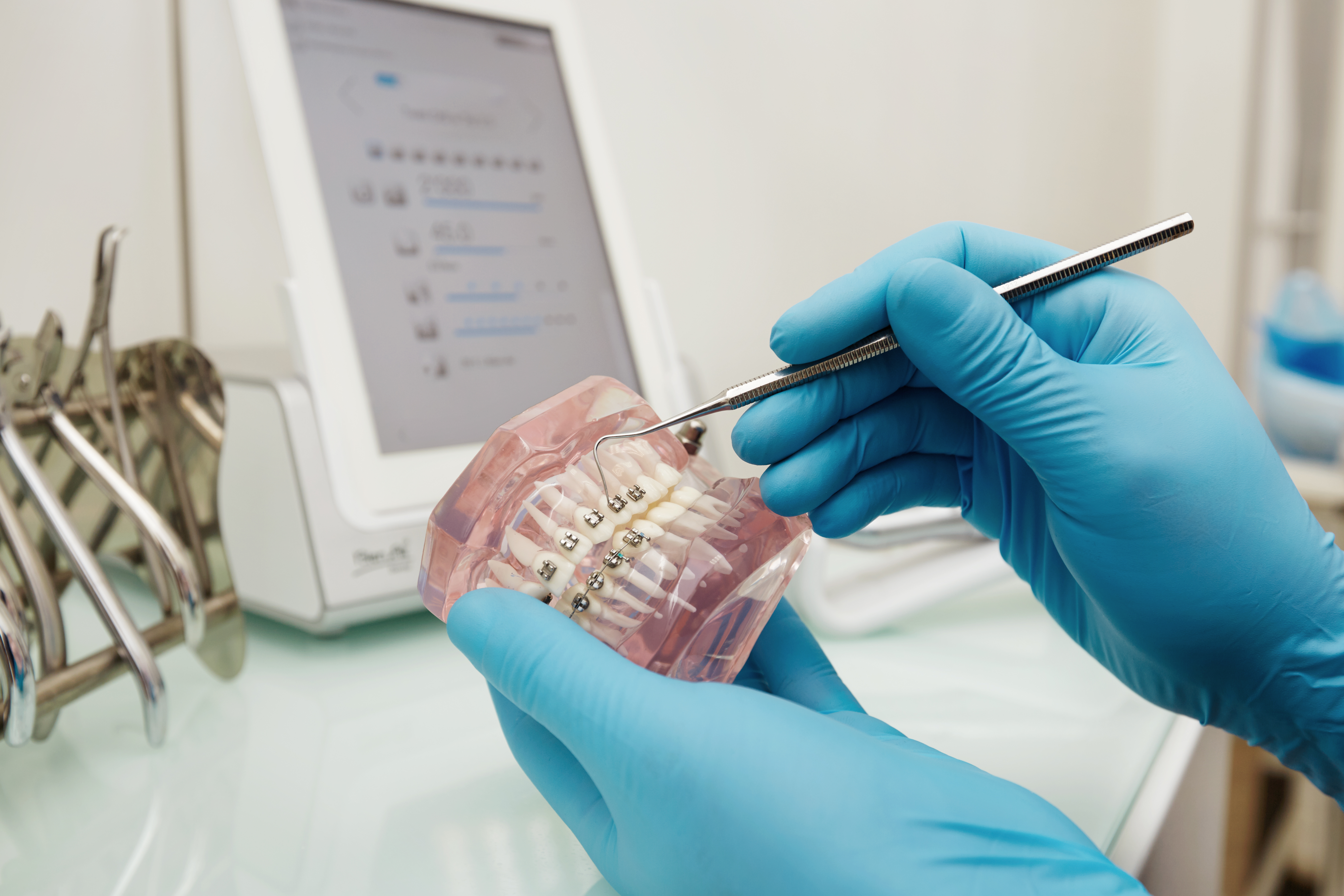 Orthodontic products